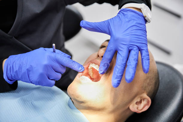 Best Urgent Tooth Repair  in West Milton, OH